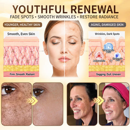 HISKIN®🛒Skin Renewal & Feminine Contour Firming Nano Microneedle Patch Powered by NAD⁺ + PDRN + EGF + Volufiline™ + Copper Peptide Technology
