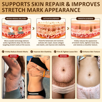 HISKIN®🛒Skin Renewal & Feminine Contour Firming Nano Microneedle Patch Powered by NAD⁺ + PDRN + EGF + Volufiline™ + Copper Peptide Technology