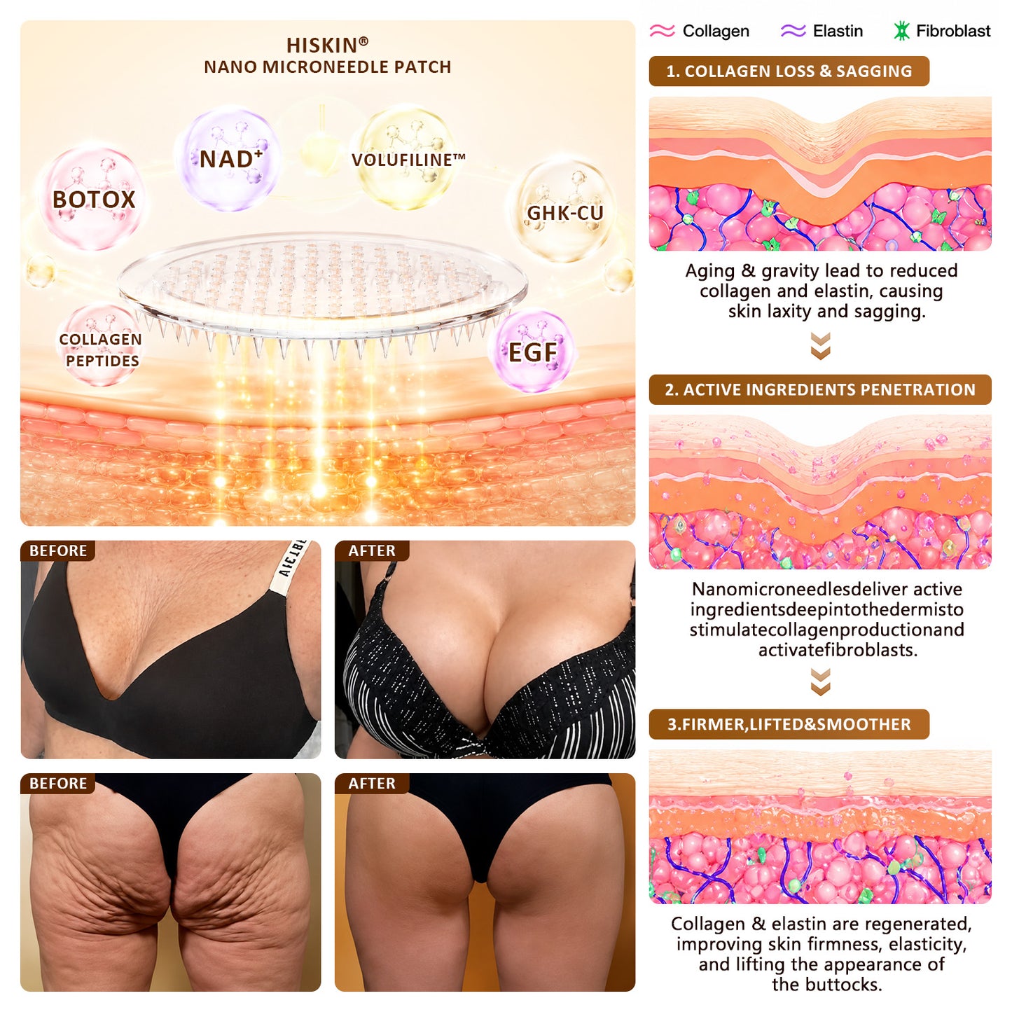 HISKIN®🛒Skin Renewal & Feminine Contour Firming Nano Microneedle Patch Powered by NAD⁺ + PDRN + EGF + Volufiline™ + Copper Peptide Technology